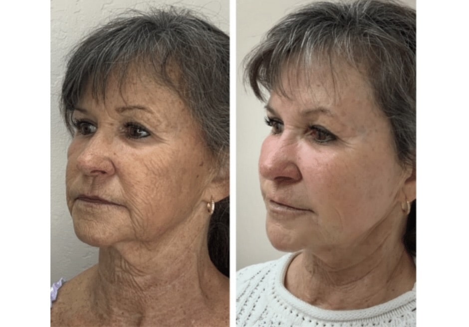 C30E2F9B 9E63 4CEC 992D E088DEB85139 1 201 a